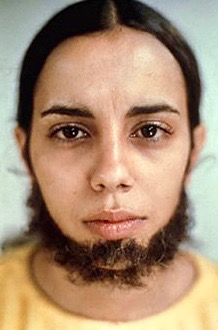 Ana Mendieta (1948-1985), Untitled (Facial Hair Transplants), 1972